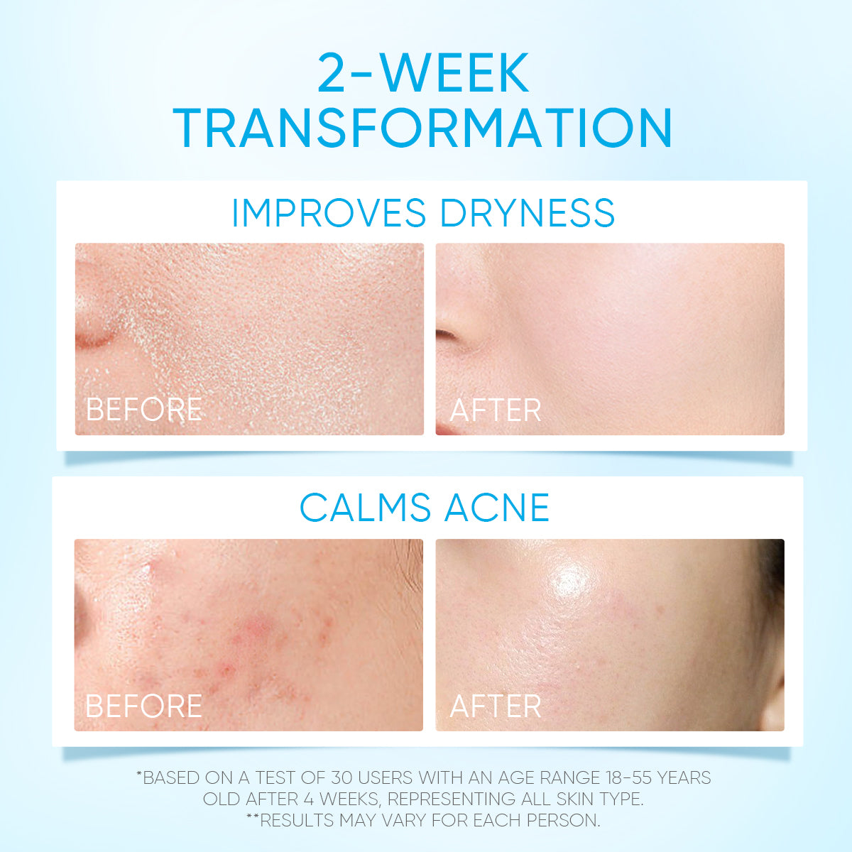 2PCS SKINCARE SET | ACID PEELING SOLUTION SERUM 30ML & 5X CERAMIDE BARRIER MOISTURIZER GEL 30G