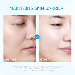 5X Ceramide Soothing Calming Essence Toner