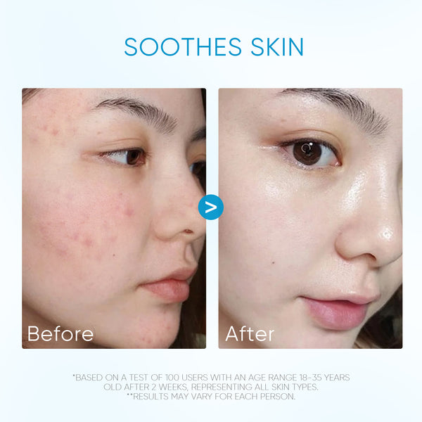 5X Ceramide Soothing Calming Essence Toner