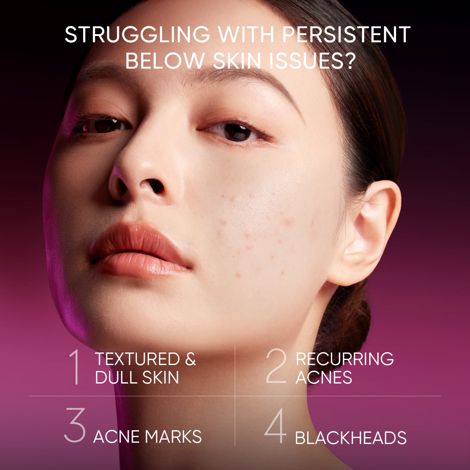 2PCS SKINCARE SET | ACID PEELING SOLUTION SERUM 30ML & 5X CERAMIDE BARRIER MOISTURIZER GEL 30G