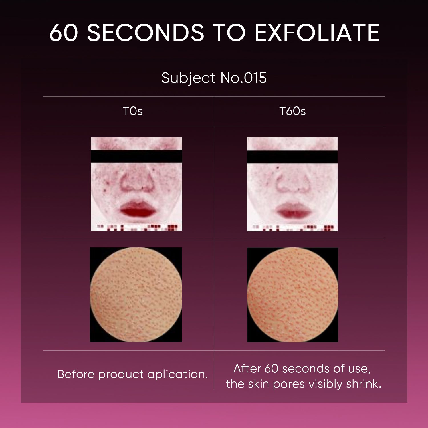 2PCS SKINCARE SET | ACID PEELING SOLUTION SERUM 30ML & 5X CERAMIDE BARRIER MOISTURIZER GEL 30G