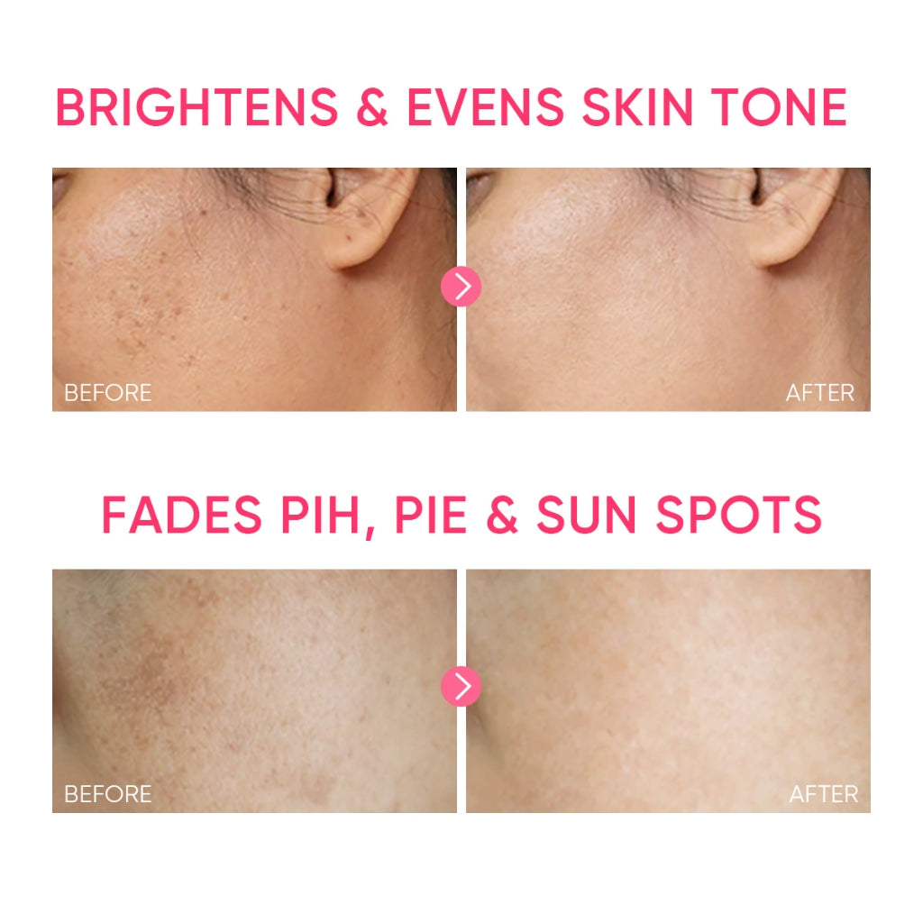 MSH NIACINAMIDE BRIGHTENING MOISTURIZER 30G
