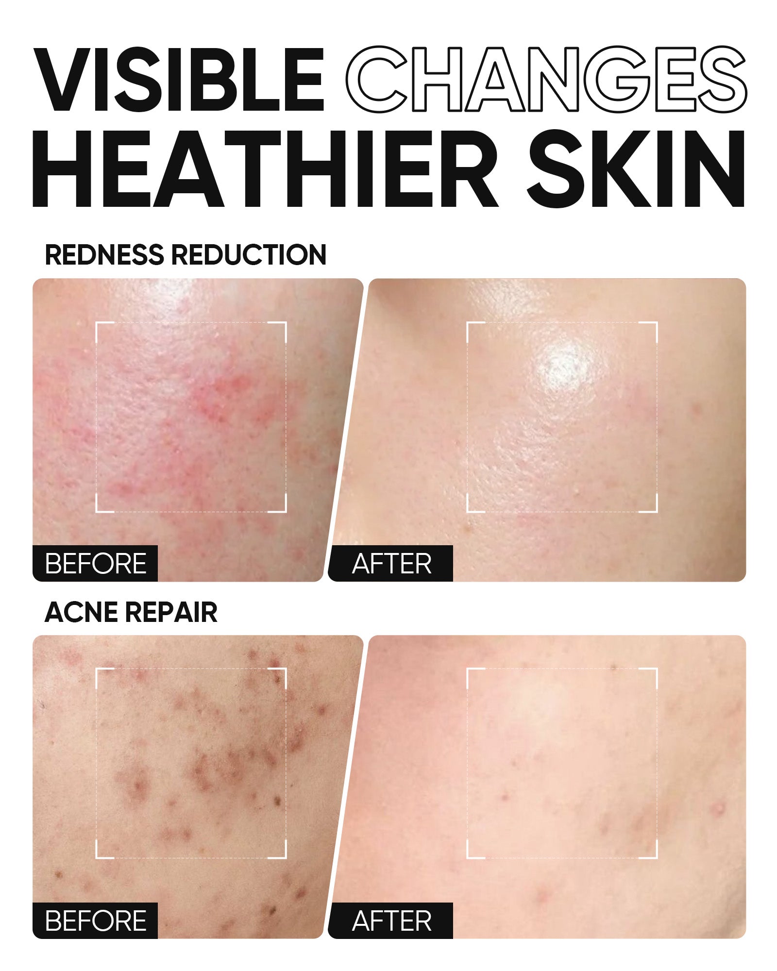 5X Ceramide Barrier Repair Moisture Gel