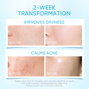 5X Ceramide Barrier Moisturizer Gel