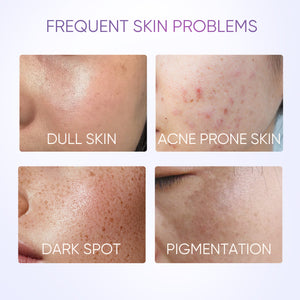 Symwhite 377 Dark Spot Serum