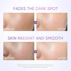 Symwhite 377 Dark Spot Serum