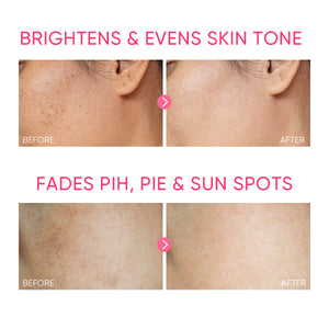 MSH Niacinamide Brightening Moisturizer Gel