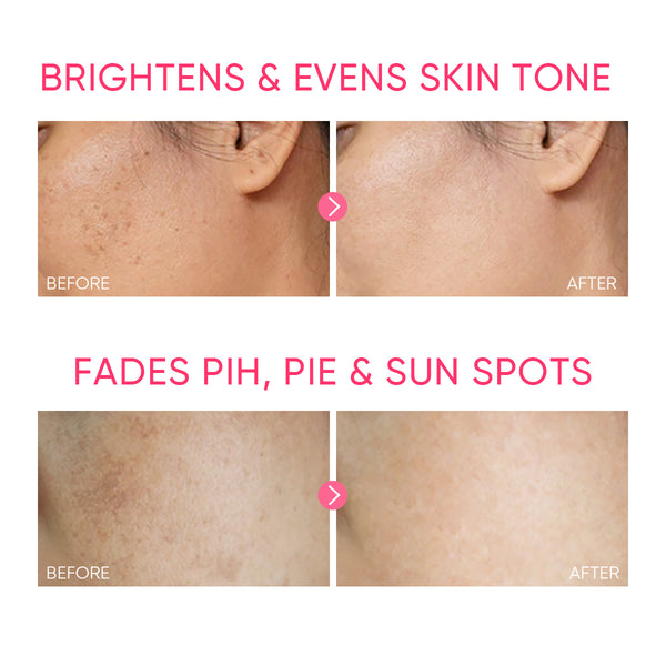 MSH Niacinamide Brightening Moisturizer Gel