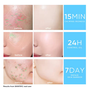 5X Ceramide Barrier Moisture Gel