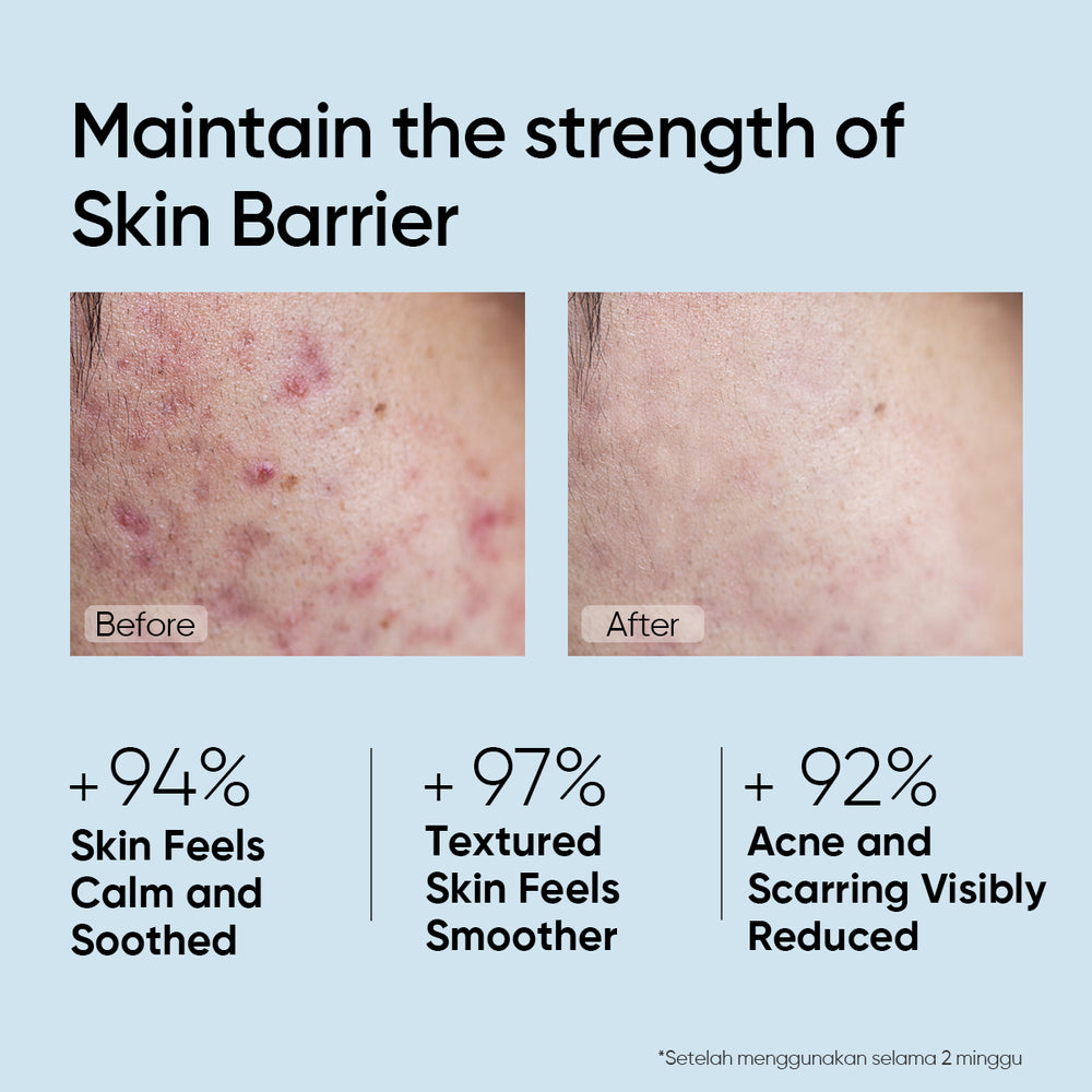 5X Ceramide Barrier Serum