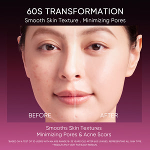 12% Acid Peeling Solution Glowing Serum