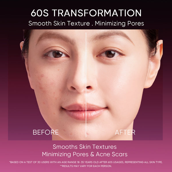 12% Acid Peeling Solution Glowing Serum