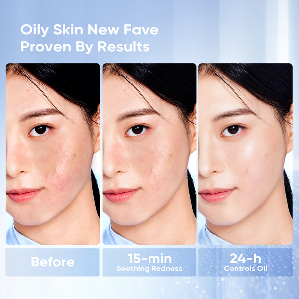 5X Ceramide Barrier Moisturizer Gel