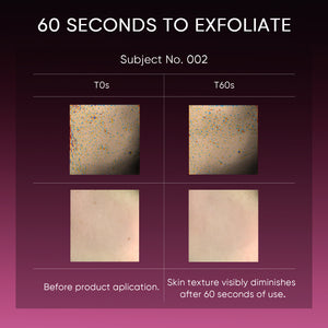 12% Acid Peeling Solution Glowing Serum