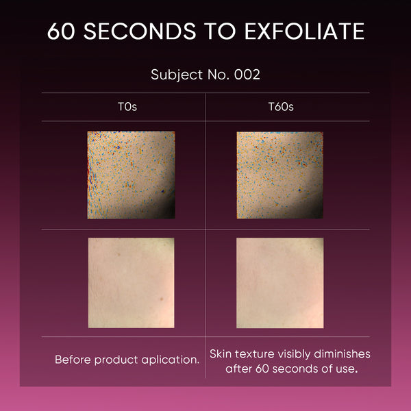 12% Acid Peeling Solution Glowing Serum