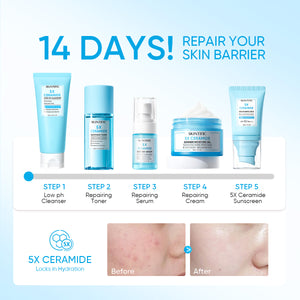 5PCS! Repair Barrier Set