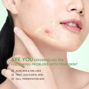 3X Acid Acne Gel Cleanser